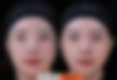 金允熙医生覆盖全品类的医美诊疗项目