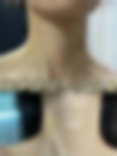 求美者真实反馈