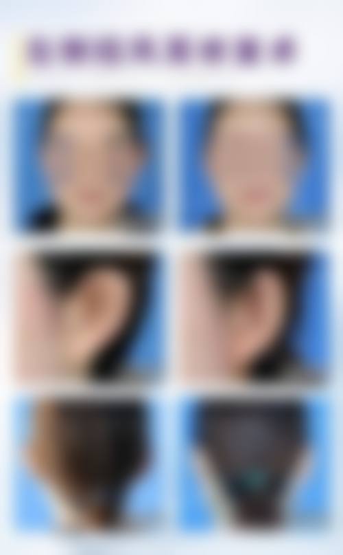 求美者真实反馈