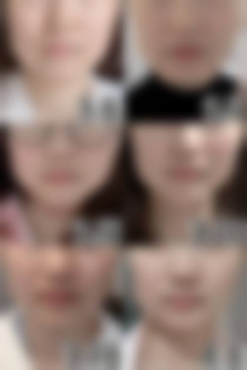 王莹雪医生坚持以求美者需求为核心定制方案