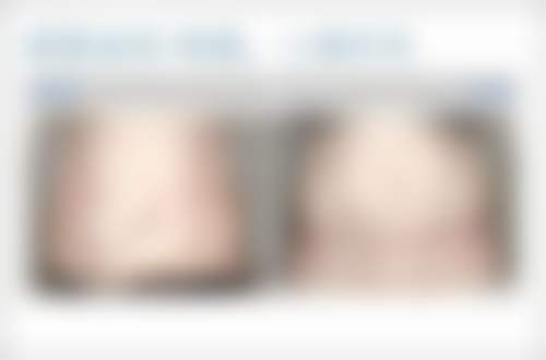 特色毛发移植技术