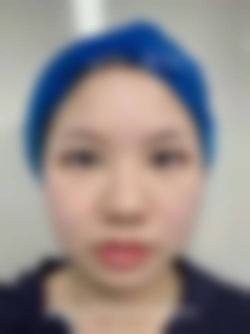 透明化医美服务，何瑞医生助力求美者安心变得更美