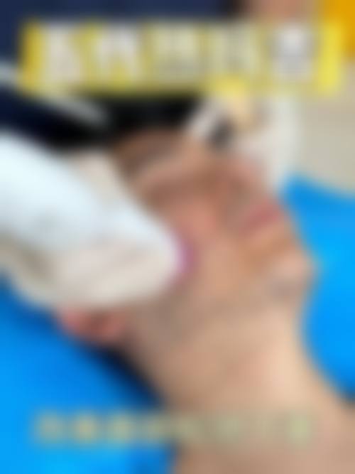 韦文峰医生主推的特色整形技术