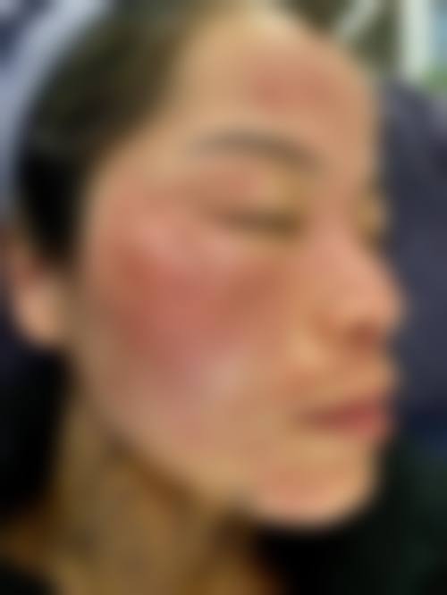 求美者真实反馈