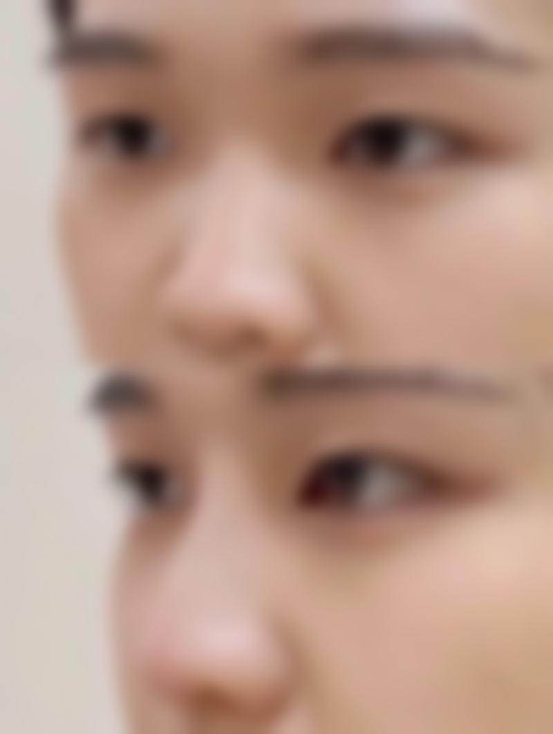 南充华美整形美容医院特色项目及技术优势