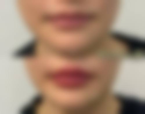 内蒙古呼和浩特博美整形医院医生团队实力