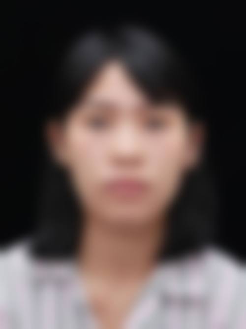 武汉绎君医疗美容门诊部求美者反馈