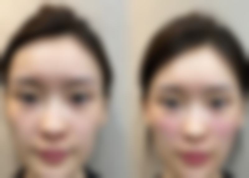 内蒙古呼和浩特博美整形医院来院路线