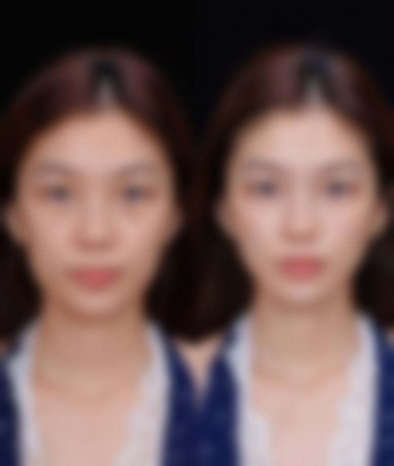 赣州欣范医疗美容门诊部特色项目及技术优势