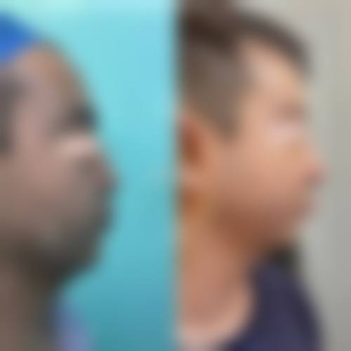 赵四海医生的个性化诊疗理念