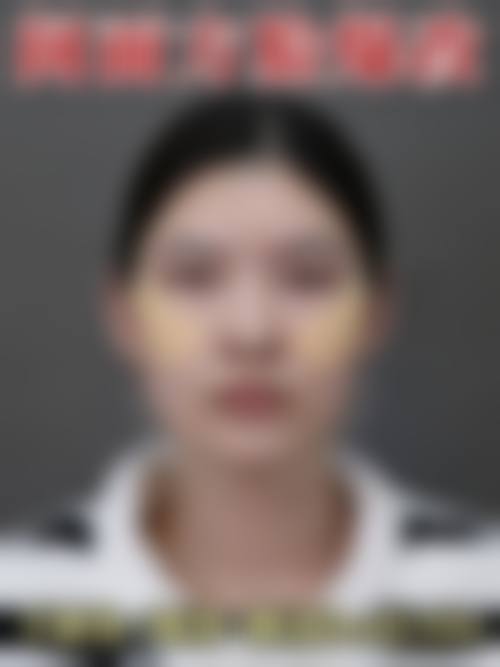 Ritz美容外科东京院特色项目及技术优势