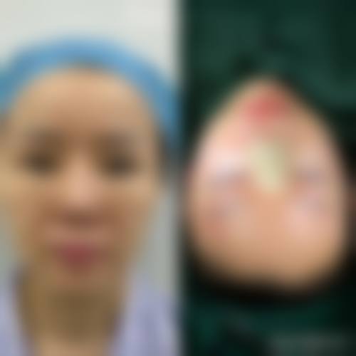 预约张玉华医生的便捷方式