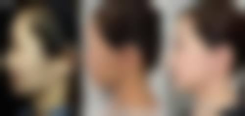 张玉华医生可开展的特色医美项目