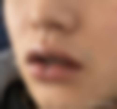 姜民赫医生的诊疗核心：以患者为中 心的个性化服务