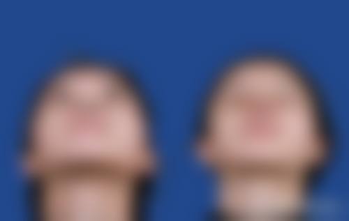 选择赵四海医生的安心医美保护