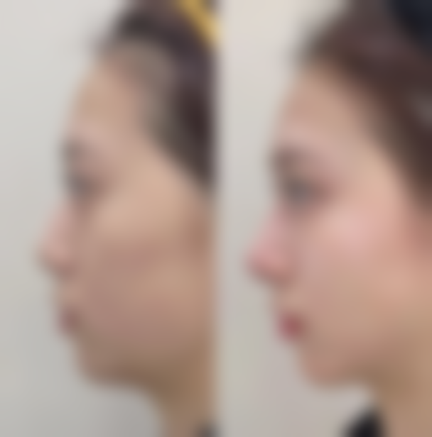 杭州虞美人医疗美容医院价格收费