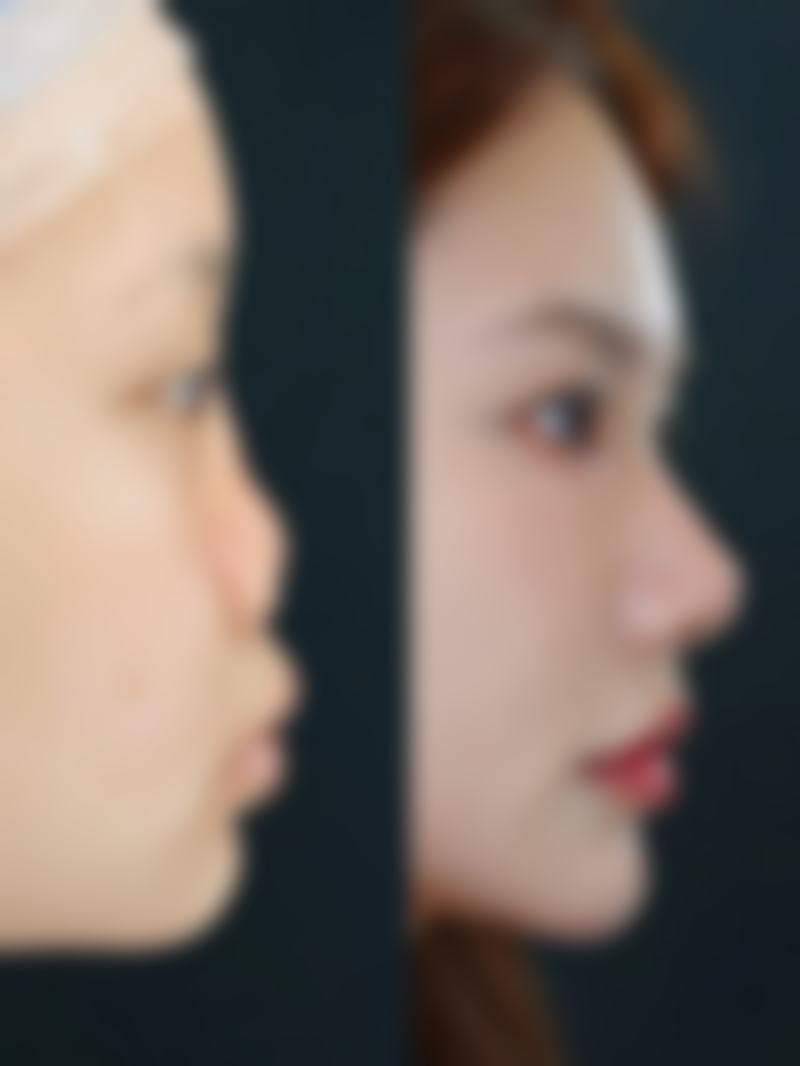 阳泉臻艺整形医院来院路线