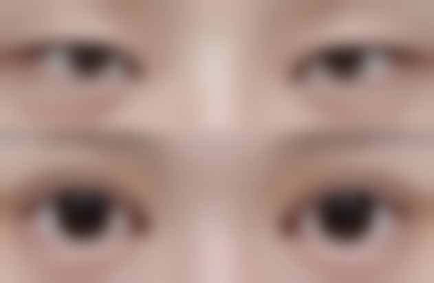 阳泉臻艺整形医院价格收费