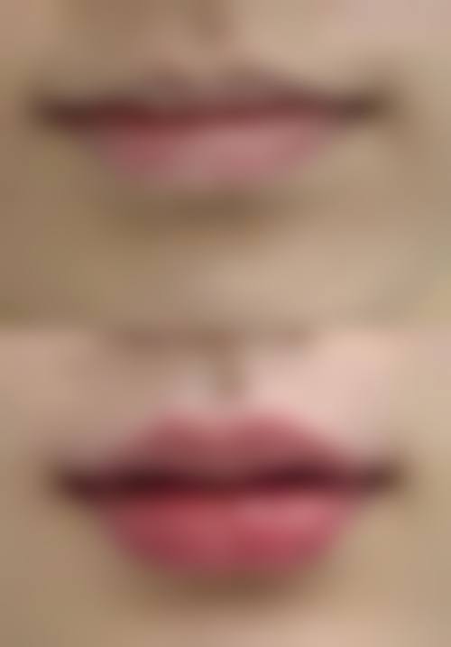 丽水美颜医疗美容诊所价格收费