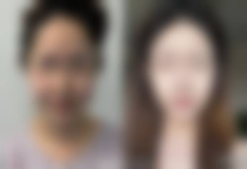 丽水美颜医疗美容诊所求美者反馈