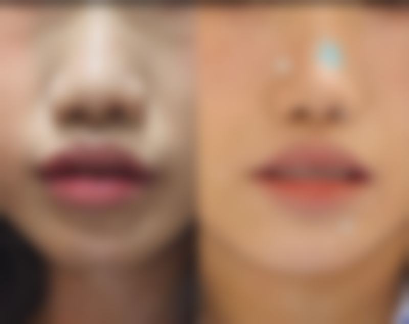 reone皮肤科医院特色项目及技术优势