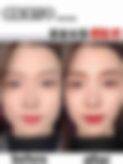 高网勤医师可开展的医疗美容项目