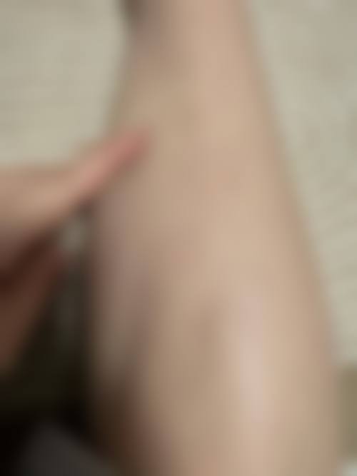 李在承院长的精细化医美技术优势