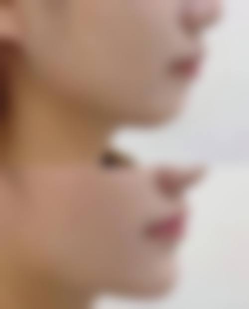 安庆市亚星医疗美容医院价格收费