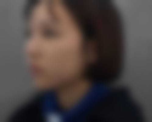 安庆市亚星医疗美容医院来院路线