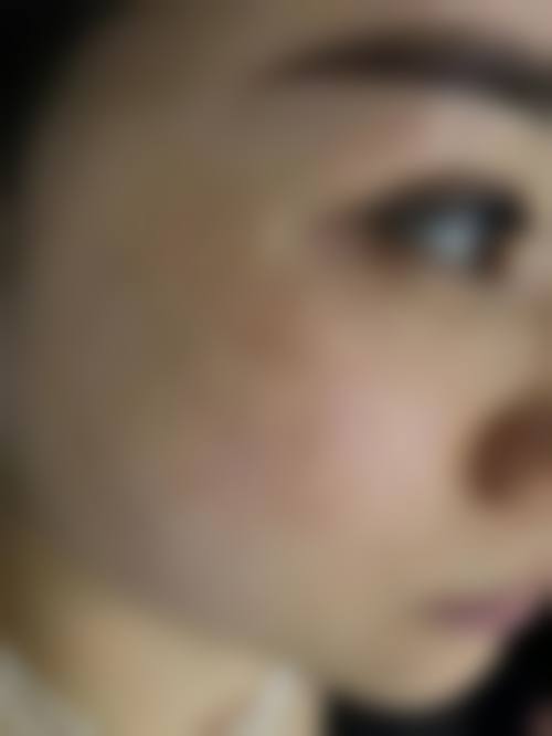 保定天媛整形美容诊所求美者反馈