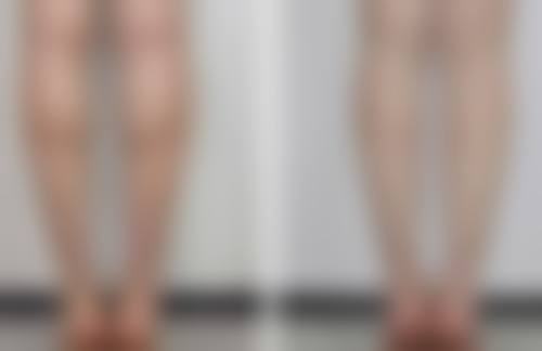 深圳医小森医嘉医疗美容诊所来院路线