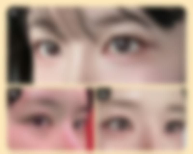 青岛卓雅医疗美容诊所求美者反馈