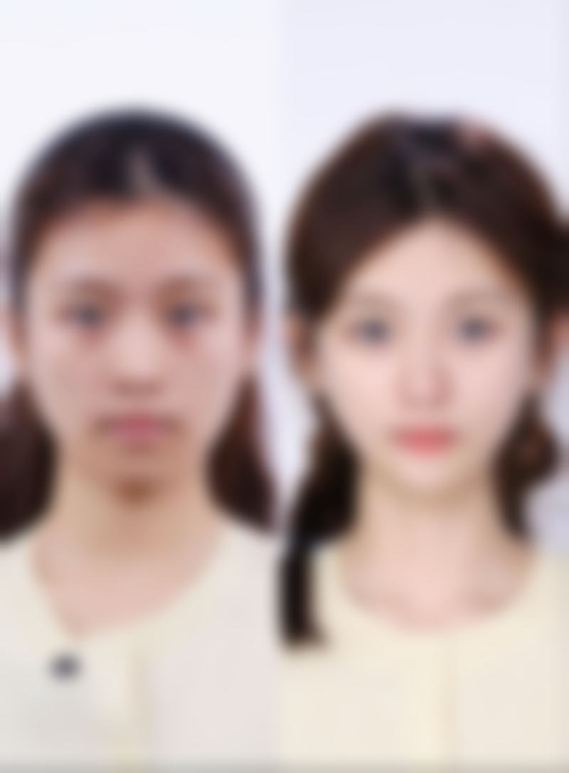 温州粉范整形美容医院价格收费