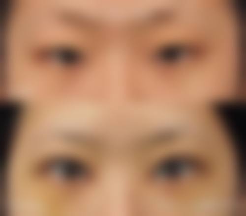 吴宰阭院长的精细化诊疗技术特色