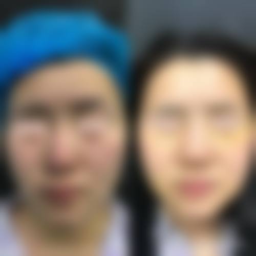 朴永信个性化诊疗：贴合求美者需求的专属方案