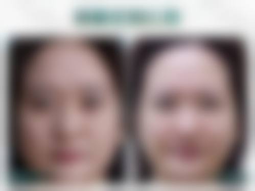 武平瑞妍整形医院求美者反馈