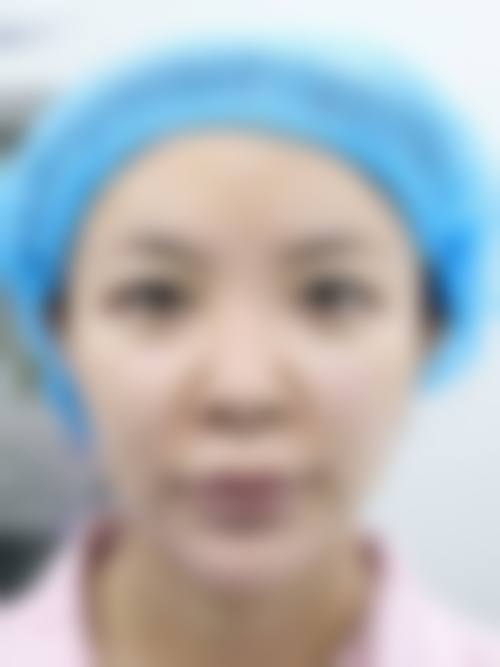 包头市悦已整形美容医院特色项目及技术优势