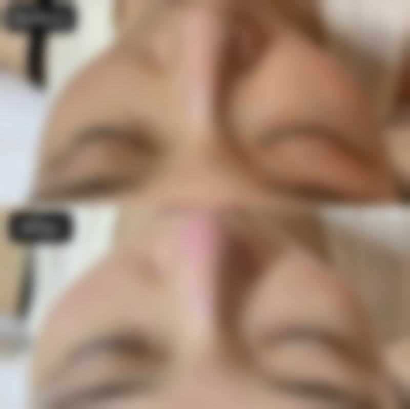 临沂星铄整形美容医院求美者反馈