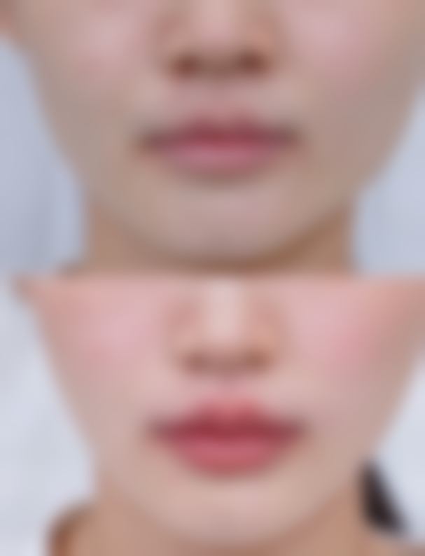 临沂星铄整形美容医院来院路线