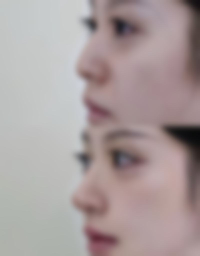 韩国BR整形外科医院简介概述