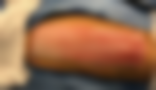 上海翔茂整形医院价格收费