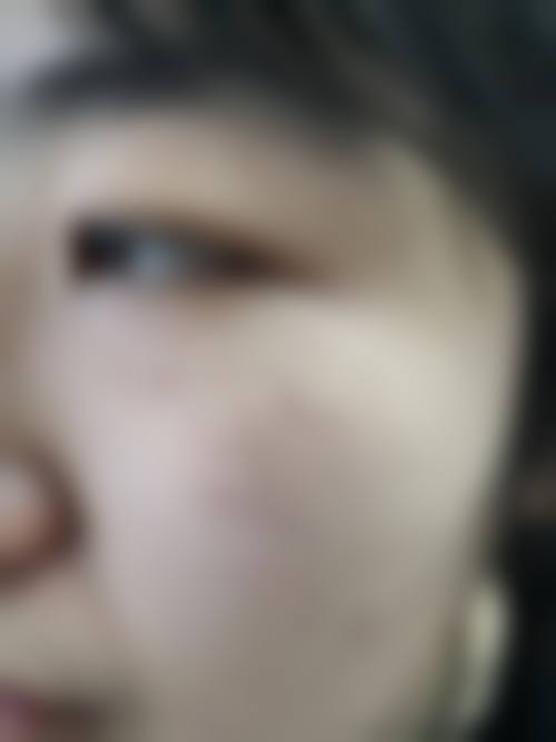 青岛美益医疗美容诊所求美者反馈