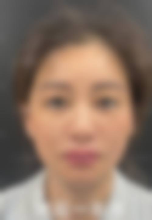 长春正韩整形医院价格收费