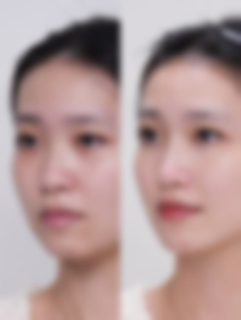 兰州艾尚美医疗美容门诊部特色项目及技术优势