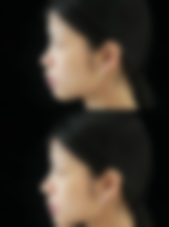 信阳奕美整形医院求美者反馈