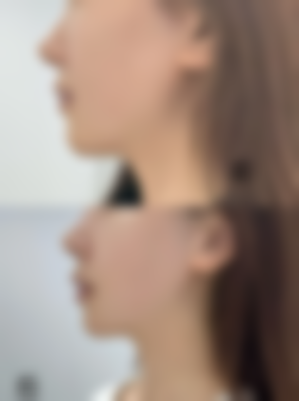 宜宾韩美整形医院求美者反馈