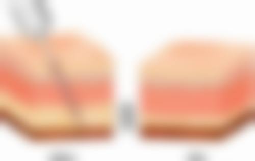 洛阳玉妃医疗美容门诊部特色项目及技术优势