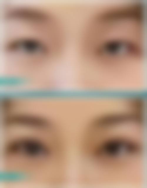 成都武侯杨才华整形医院求美者反馈