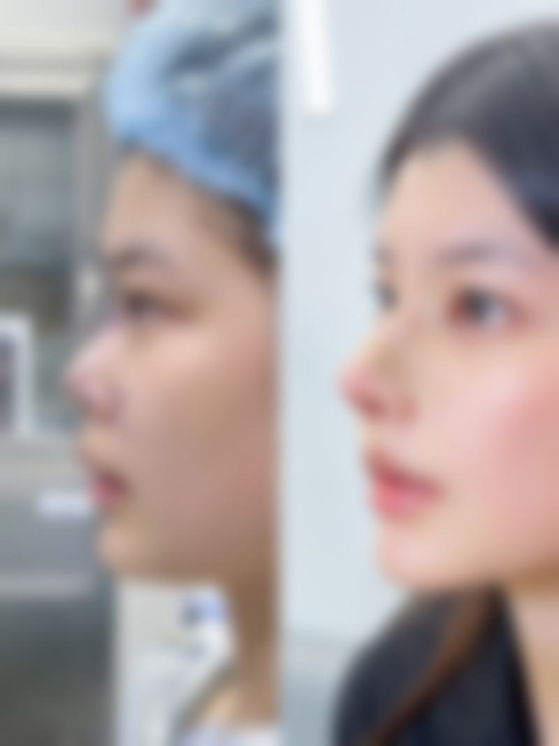 无锡爱思特春天整形医院来院路线