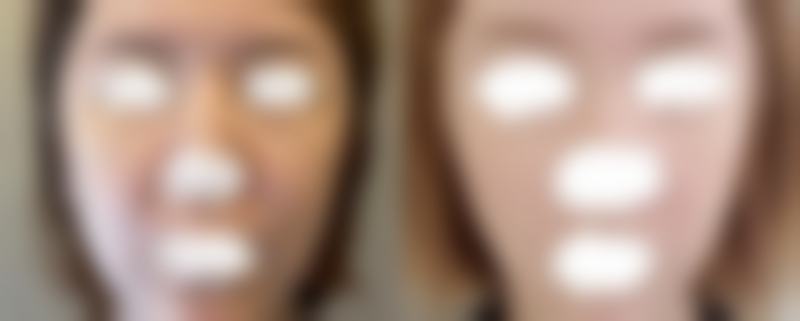 惠州雍禾医疗美容门诊部求美者反馈